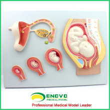 ANATOMY15 (12453) Modelo de proceso de desarrollo embrionario, desarrollo del huevo no fertilizado al noveno mes